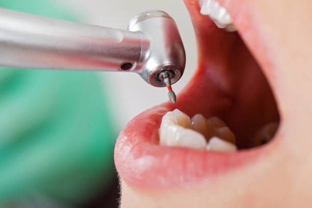 Best Emergency Root Canal Therapy in Harlem Heights, FL
